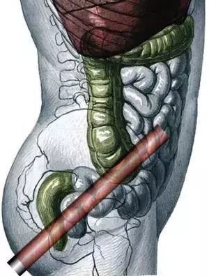 变蚊人 相关产品