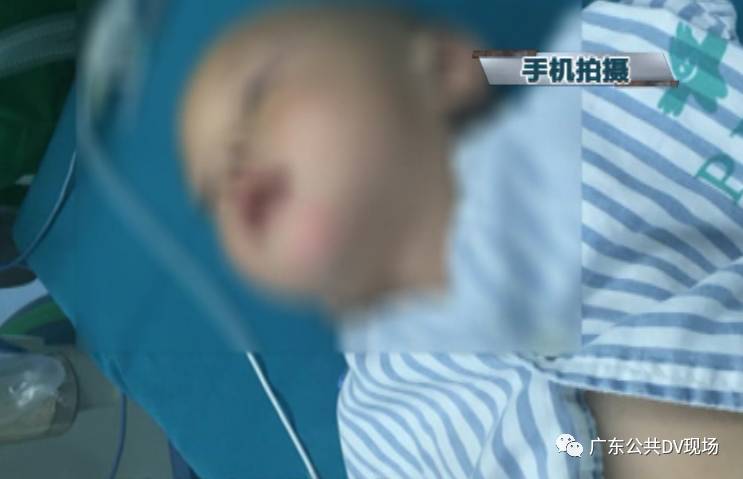 壳中裂缝 相关产品