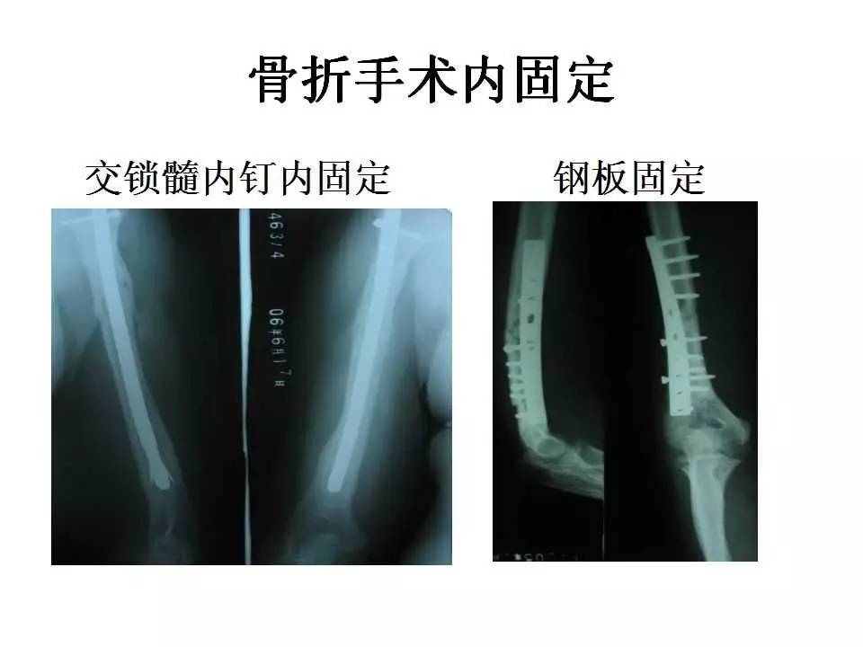 你们这些人 相关产品